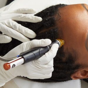 Keravive For Scalp