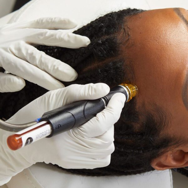 Keravive For Scalp