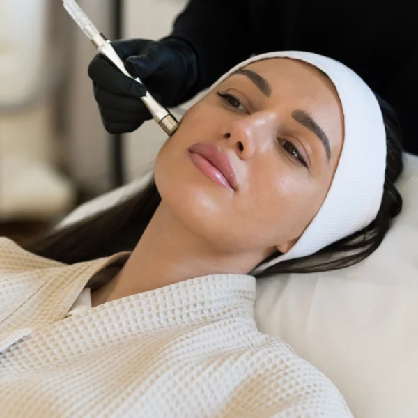 Diamond Peel Microdermabrasion