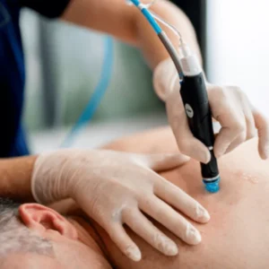 HydraFacial Back