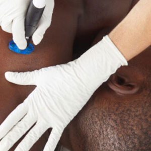 Men's HydraFacial Back