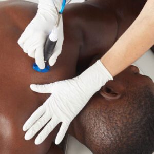 Men's HydraFacial Back