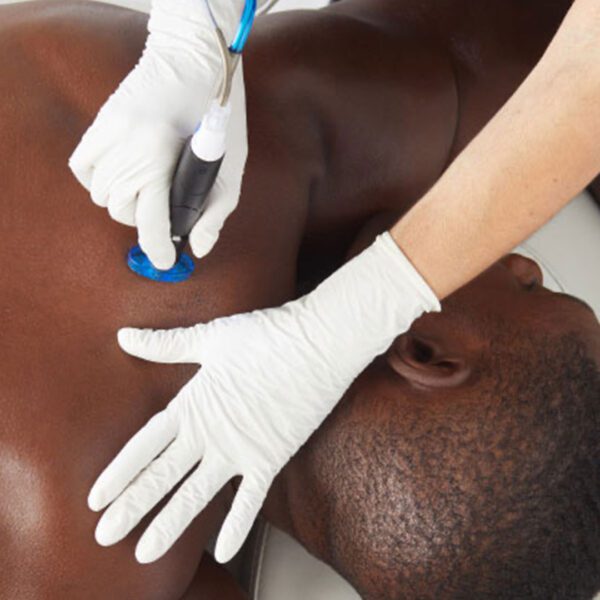 Men's HydraFacial Back