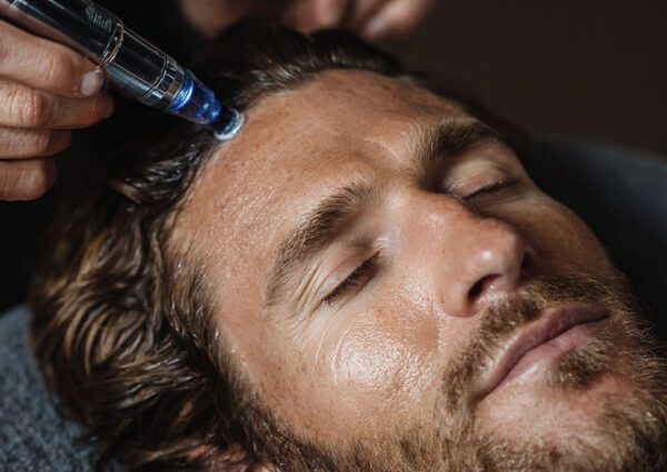 Men's Keravive For Scalp