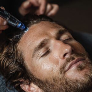 Men's Keravive For Scalp
